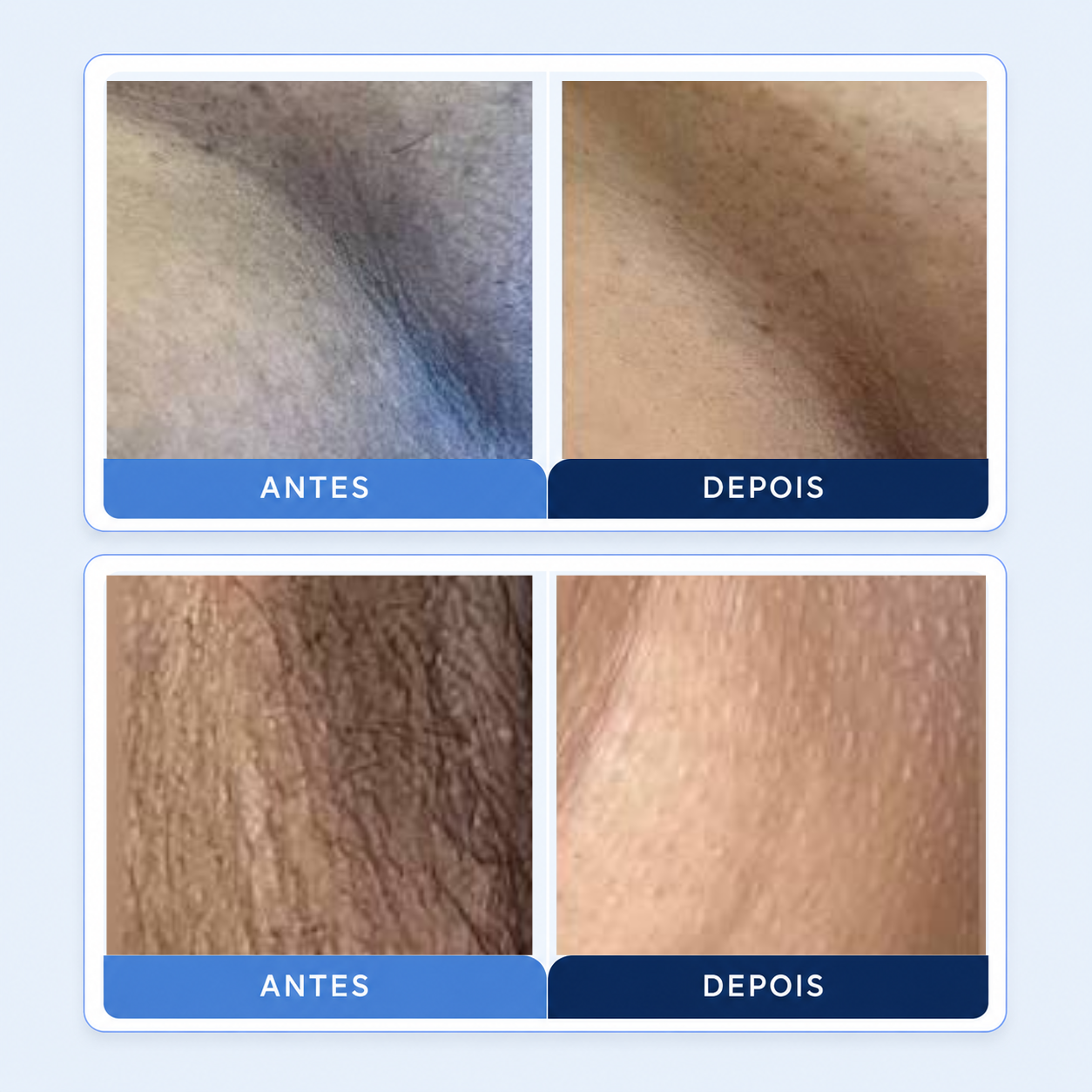 Antes e depois — resultados 3