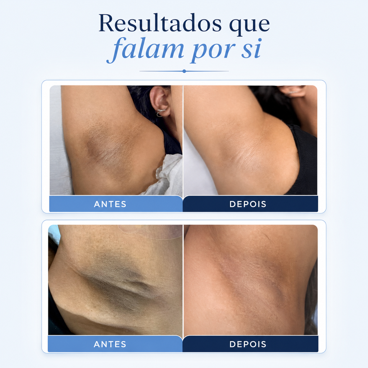 Antes e depois — resultados 1