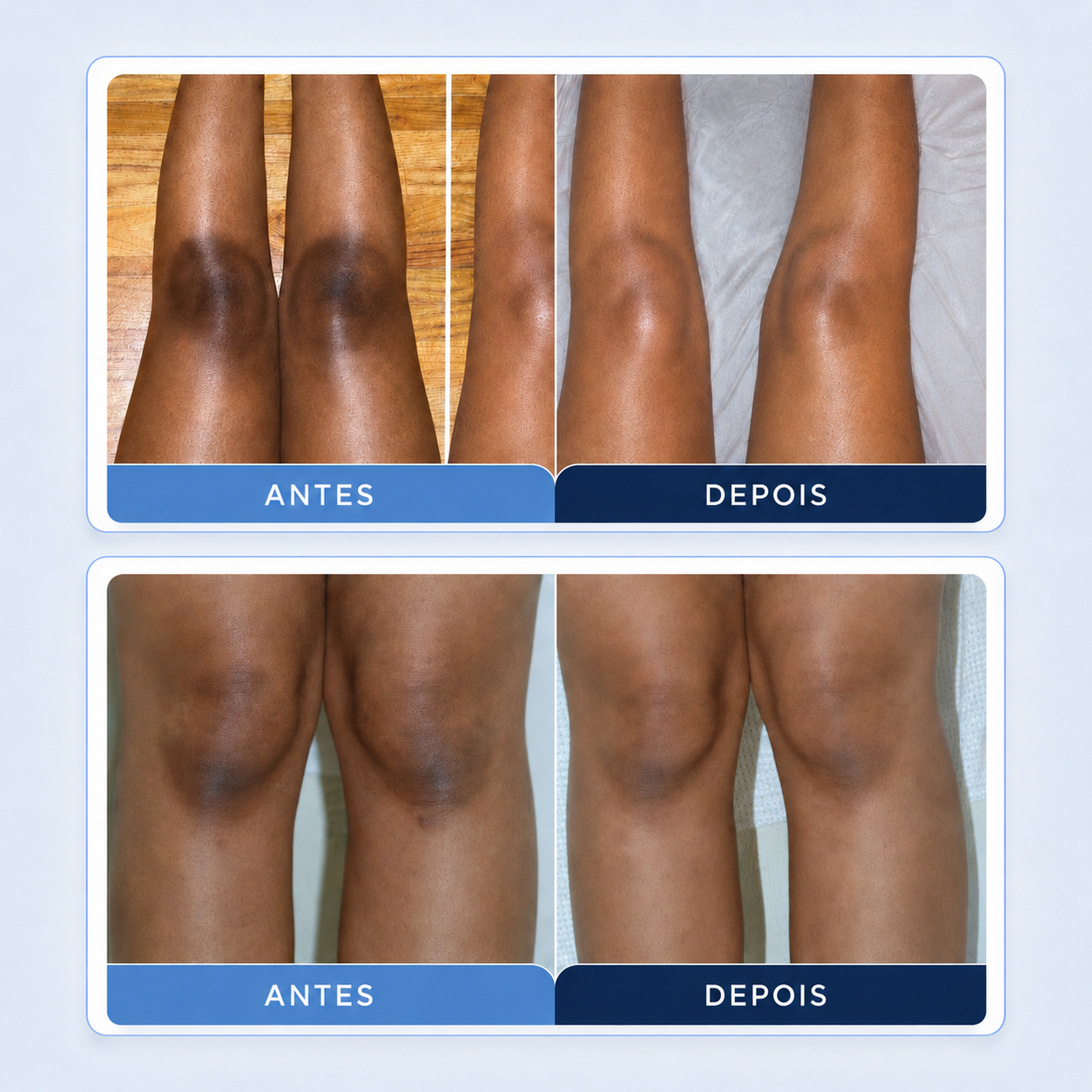 Antes e depois — resultados 2